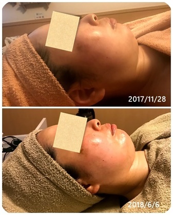 痩せてないのに顔が小さくなる！