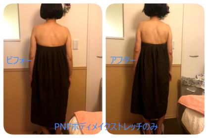 骨盤矯正ってどういいの？