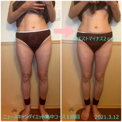 ニュースキャンダイエット集中コースモニターC様１回目
