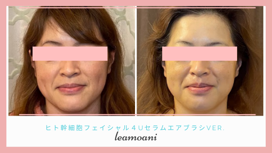 色白、小顔に嬉しい驚き。
