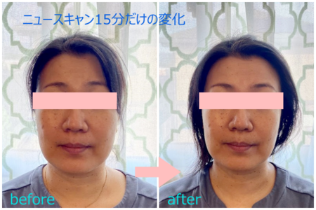 たった20分で別人級の小顔ー座ったままでメイクしたままで！