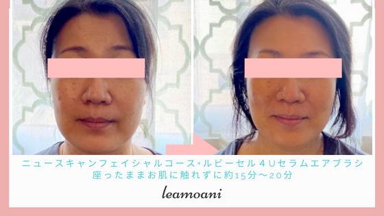座ったままお肌に触れずに20分でこの変化！