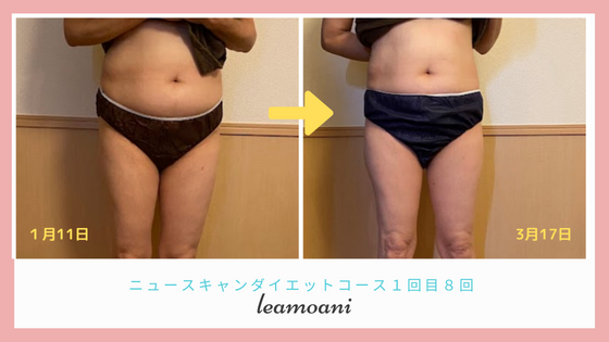 ニュースキャンダイエット８回コースサイズ変更はなかったけど。。。！