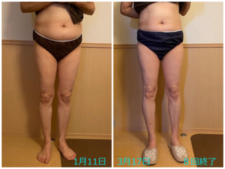 ニュースキャンSWⅢ®によるダイエットコース８回のビフォーアフター